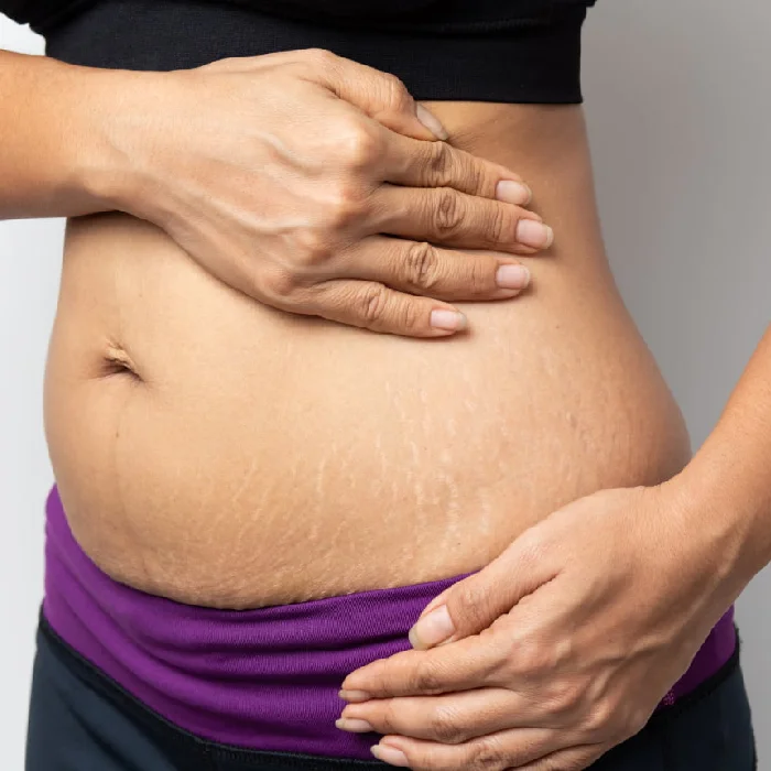 Postpartum Body Positivity